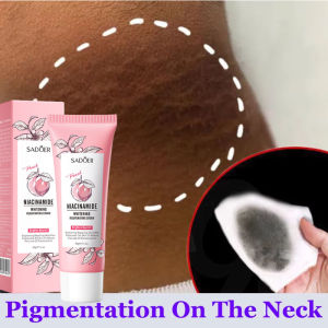 SADOER | Whitening Body Cream For Dark Skin Armpit Thigh Inner Joint Fade Intimate Area Underarm Body Care Private Part Brighten Lotion