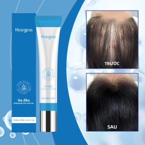 Tinh Dầu Dưỡng Tóc Gừng - Làm Mượt Tóc Chống Xù Tăng Cường Sức Khỏe Nuôi Dưỡng Da Đầu Kích Thích Mọc Tóc 20G