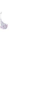 set 5 Bộ bodychip liền váy cotton cho bé 3 tháng - 2 tuổi