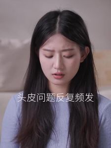 SHULIN | Dầu Gội Làm Dịu Chống Ngứa Đầu Hiệu Quả Cho Da Đầu Nhạy Cảm