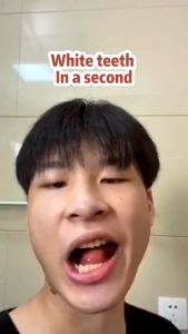 Pasta Gigi Pemutih dan Perontok Karang Gigi Baking Soda Toothpaste - Pemutih Gigi Kuning Permanen Ampuh Viral di Pembersih Gigi Biar Putih / Pencegah Gigi Berlubang 110g