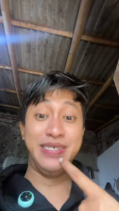 Penambal Gigi Berlubang 250 Butir - Temptooth Tambal Gigi Palsu Sementara 250 Butir - Temporary Tooth Repair Kit Denture Teeth 250 Butir