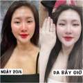 [CHÍNH HÃNG 100%] Viên Ngậm Trắng Da 𝐂𝐈𝐍𝐃𝐄𝐑𝐄𝐋𝐋𝐀 𝐏𝐔𝐌𝐏𝐊𝐈𝐍 𝐂𝐎𝐀𝐂𝐇 𝐇𝐀̀𝐍 𝐐𝐔𝐎̂́𝐂.. 