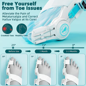 CCW 1Pcs Upgraded Bunion Corrector Toe Seperator Splint Straightener Foot Care Tool Pedicure Separator Corrector Spreade