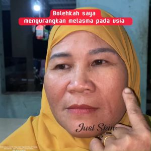 Just Skin DOC Retinol Serum Anti-aging serum Collagen booster Skin aging prevention Moisturizing Reduce dark spots Reduce freckles - Lazada