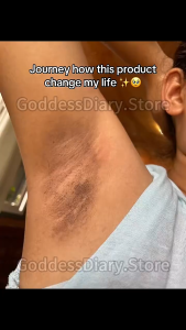 （BUY 1 TAKE 1）LBLS Organic Skin Whitening Deodorant Roll-on (40ml) for Removing Body Odor