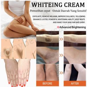 Krim Pemutih Whitening Cream Brightening Cream Armpits Knees Arms Thighs Skin Whole Body Whitening Remove Melanin 美白霜 50g Skin Whitening massage cream Private Parts Underarm putih celah peha whitening cream body underarm