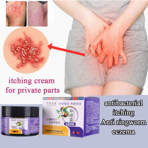 Ubat gatal kemaluan Private parts itchy cream Ubat gatal kulit 30g Strong antibacterial Quick itching relief ubat celah kangkang gatal Private parts Antifungal cream anti-itching cream Eczema Psoriasis cream