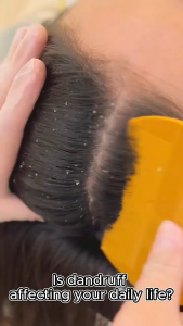 SADOER Coconut Oil Shampoo Deep Cleaning Get Rid of Dandruff Repair Damage Moisturizing Shampoo