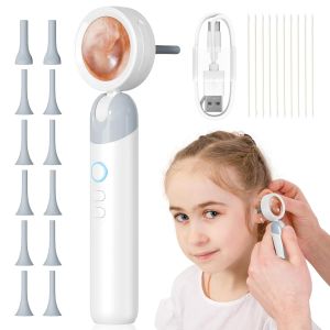 Visual Ear Camera 3.2mm Lens 1080P HD Ear Mouth Nose Check with 4 Lights for Kids and Adults Pets Support Take Photo Connect PC