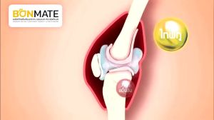 อัลติเมทบอนเมท 20 เม็ด จำนวน 5 กล่อง