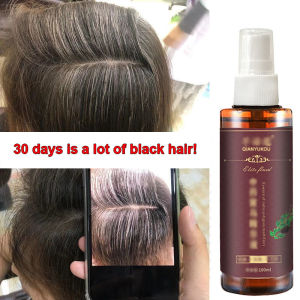 Hitam Spray Hair Growth Serum Spray Anti Tonik Rambut Rontok Pertumbuhan Rambut Cepat Hair Treatment Memelihara dan Memperbaiki 100ML-💖Uiabgt