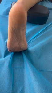 Dụng Cụ Chải Cơ IASTM Thép Không Gỉ Đa Năng Hỗ Trợ Massage Thư Giãn Cơ Bắp