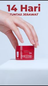 SR12 ACNE CREAM: Tunaskan Jerawat Dalam 14 Hari