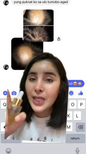 Minoxidil 20%: Maximum Strength Hair Regrowth Formula