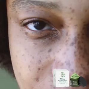 EELHOE Natural spot cream lightens spots and acne moisturizes and nourishes the skin whitens and brightens and rejuvenates and beautifies the skin.30g
