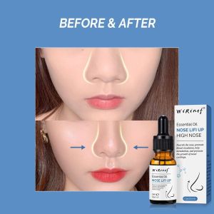 Nose Lifting Essential Oil penjagaan kecantikan hidung Firming Make the nose higher Beautiful nose essential oil
