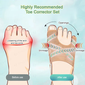 Hallux Valgus Corrector Big Toe Protrusion Improvement Split Toes Can Wear Shoes Men and Women Toe Correction Artifact Leggings