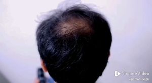 ผงไฟเบอร์เพิ่มผมหนา ปกปิดผมบางและหัวล้าน Hair Building Fiber ขนาด 27.5 กรัม