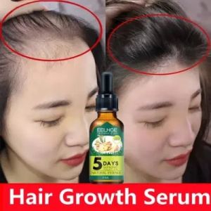 Hair Care Hair Growth Serum Essential Oils Essence Hair Loss Liquid Health Care Beauty Dense Hair Growth Serum 30ml-Penumbuh Rambut - Penumbuh Rambut Botak Pria -Serum Penumbuh Rambut -Penumbuh Rambut -mengurangi Rambut Rontok