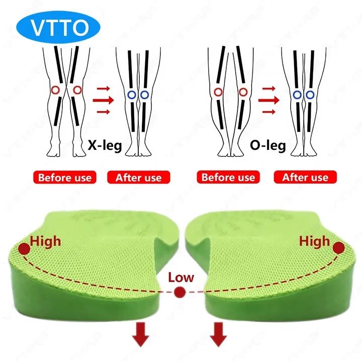 VTTO O/X-Leg Orthopedic Insoles Arch support insole corrigibil Bow