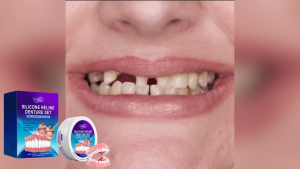 Adjustable Upper and Lower Denture Set - Realistic Natural Teeth Transparent Tooth Arch Design - Easy-to-Install Full Mouth Replacement Dentures - Comfortable and Durable Plastic Dentures with Natural Gum-Shaped Base - Suitable for All Jaw Types