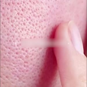 Sadoer Vitamin E Serum Serum Pengecil Pori-Pori Wajah