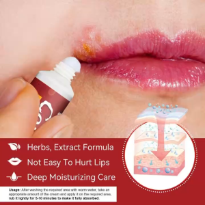 Kem Bôi Hỗ Trợ Giảm Mụn Rộp Môi Nhiệt Miệng Sumifun Cold Sore Relief Cream Làm Dịu Nhanh Phục Hồi Môi Khỏe 20G Chính Hãng
