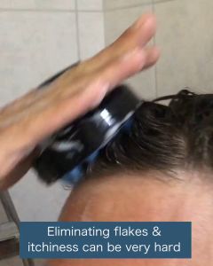 NoFlaky Brush | NOFLAKY BRUSH ORIGINAL IFN SISIR KRAMAS