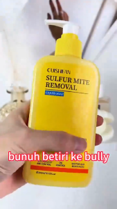 3-in-1 Sulfur Body Wash 300ml Antibacterial Anti acne Moisturizing Anti-itch Cleansing Sulfur Soap Mite Removal Body Wash