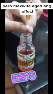 Warts Remover Original Mole Remover Effective Skin Tags And Warts Remover Kulogo Remover Original Nunal/An An/ Kasoy Cream Warts Remover Super Effective Dermacare Serum & Essence Pure kasoy Oil No Chemicals Authentic