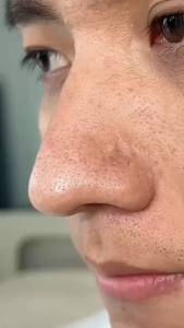 Avocado Bubbles Facial Mask Moisturizing Blackhead Removal Mud Mask moisturizing oil controlling blackheads and acne removing deep cleansing pore shrinking and mud fil美白面膜