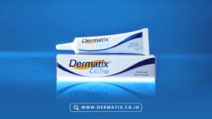 DERMATIX ULTRA ORIGINAL 15 GR MADE IN USA SALEP DAN KRIM PENGHILANG BEKAS LUKA