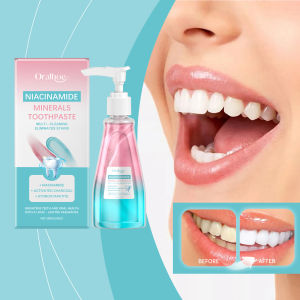Niacinamide Bleaching Toothpaste Dental Stains Removing Prevent Bad Breath Oral Cleaning Refreshing Reduces Plaque Toothpaste