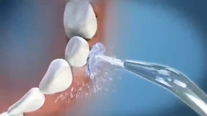 YANPAI - Tăm Nước Đa Năng 4 Đầu Thay Thế Máy Tăm Nước Cầm Tay Mini - Làm Sạch Sâu Kẽ Răng Ngừa Sâu Răng & Massage Nướu - Quà Tặng 4 Đầu Phun USB Sạc Nhanh