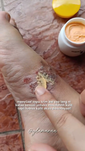 👍 BaiYaoLang ครีมลดอาการคัน👍ครีมแก้คัน 20g กลากเกลื้อน สะเก็ดเงิน สิวที่หลัง เชื้อรา สมุนไพร ลดรอยแดง ลดการคัน ออร์แกนิค ใช้ทาได้ทุกตำแหน่งของร่างกาย