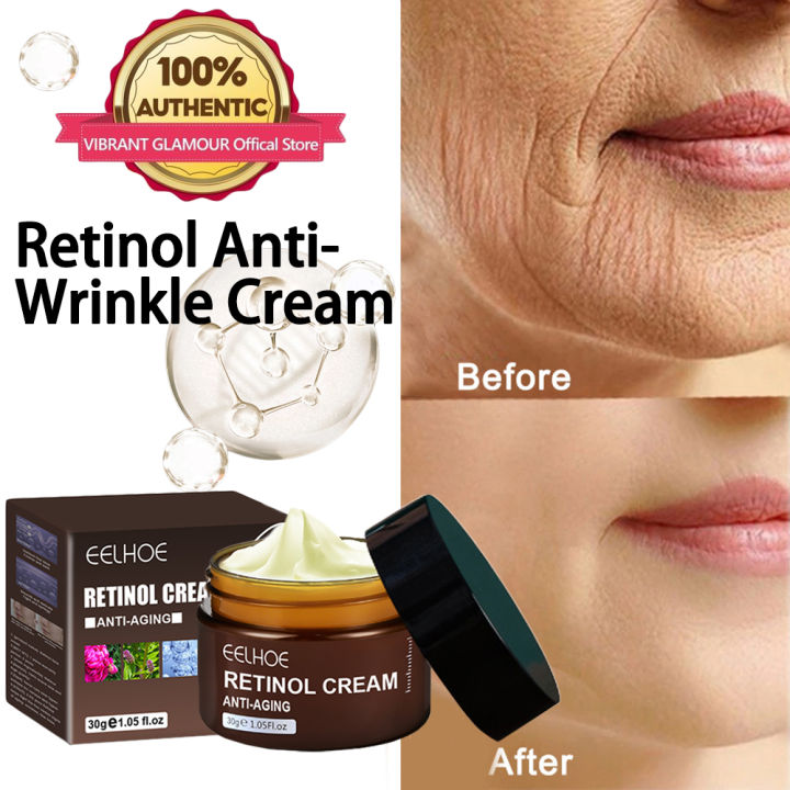 NYL EELHOE Retinol Wrinkle Remover Face Cream With Collagen Legit