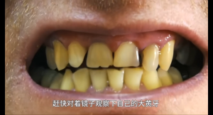 Whitening Toothpaste for Tobacco Stains Removes Smoking-Induced Plaque Strengthens Gums and Enamel Prevents Cavities 100g