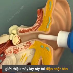 Bộ dụng cụ hút ráy tai cho trẻ máy hút ráy tai nhật bản dụng cụ lấy ráy tai an toàn máy hút ráy tai chân không thiết bị làm sạch tai xoắn ốc