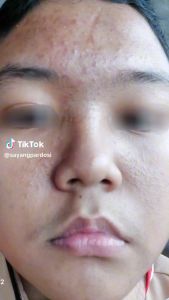 Dricha paket repairing original bpom