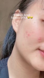 MS GLOW WHITE CELL DNA SERUM: Pengganti Hydroquinone Harian 15 ML Serum Wajah