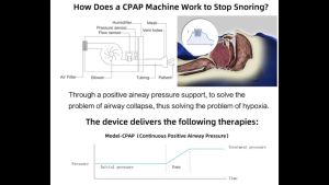 BMC Cpap Machine BMC Portable CPAP Breathing Machine (Auto) with Mask Anti Snoring Cpap BMC G2S A20