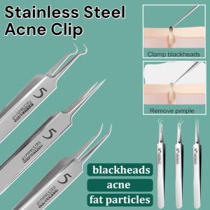 3 pcs Stainless Steel Acne and Blackhead Remover Tweezers Face Care Tools Pore Cleanser Acne Clip Blackhead Extractor