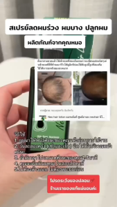 Neo Hair Lotion ส่งตรงจากโรงงาน ผม บุรุษ บำรุงผม kgd.klongsamwa