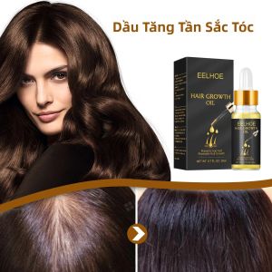 Tinh Dầu Huyết Thanh Mọc Tóc Nhanh Dành Cho Nam Và Nữ Chống Rụng Tóc Sửa Chữa Da Đầu Thúc Đẩy Mọc Lại Tóc 20ml