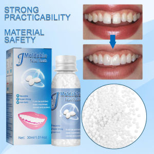 【Ready Stock】Tooth Filling Solid Gigi palsu Denture Material Temporary Tooth Repair Kit DIY False Teeth Glue Fix Broken Gaps Filling Solid 30ml