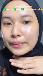Krim Pemutih Flek Noda Memudar & Menghilang Melanin