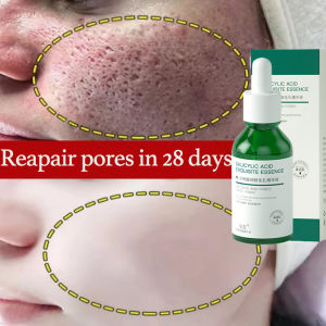 Salicylic Acid Pore Refining Essence Blackhead Removal and Acne Scar Repair 30ml Pore minimizer Balance oil and tighten skin Moisturizing