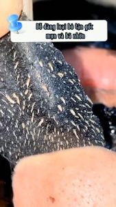 Mặt Nạ Gel Lột Mụn Đầu Đen Mụn Cám Loại Bỏ Mụn Trứng Cá Thu Nhỏ Lỗ Chân Lông Làm Sạch Da - Lột Sạch Mụn Đầu Đen Mụn Cám Bụi Bẩn Lông Tơ Trên Mặt Thải Độc Cho Làn Da