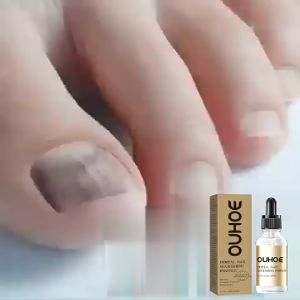 OUHOE เอสเซ้นบำรุงเล็บ เซรั่มซ่อมแซมเ บำรุงเล็บ เคราตินบำรุงเล็บ ซ่อมแซมเล็บ Herbal Nail Nourishing Essence ของ OUHOE